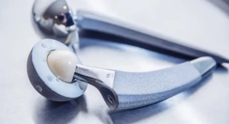 3D Printing for Medical Titanium Bone Implants 3D Printing for Medical Titanium Bone Implants