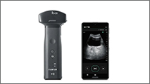 Wireless Ultrasound Diagnostic Imaging Device