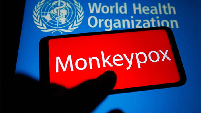 Multiple companies complete development of monkeypox test kits